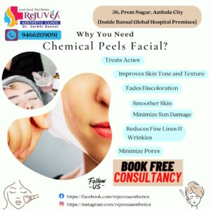 Chemical Peels Facial
