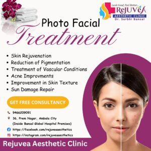 Photo Facial Treatment