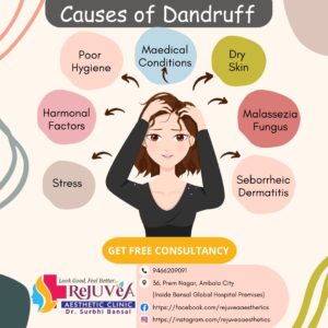 Causes of Dandruff