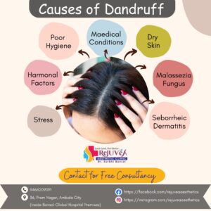 Causes of Dandruff