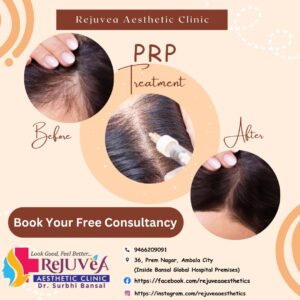 PRP Treatment